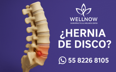 Hernia de Disco: Causas, Síntomas y Tratamiento Quiropráctico