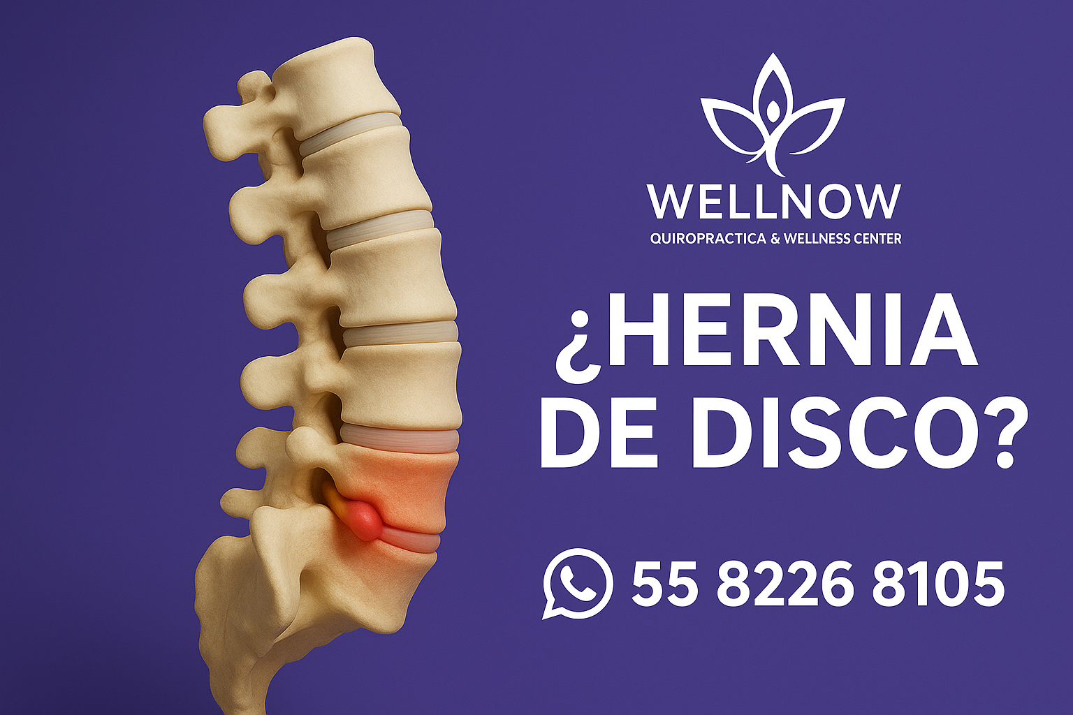 ¿Hernias de disco? Ven a WellNOW Quiropráctica